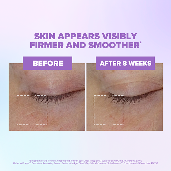 Better With Age™ Multi-Peptide Moisturizer