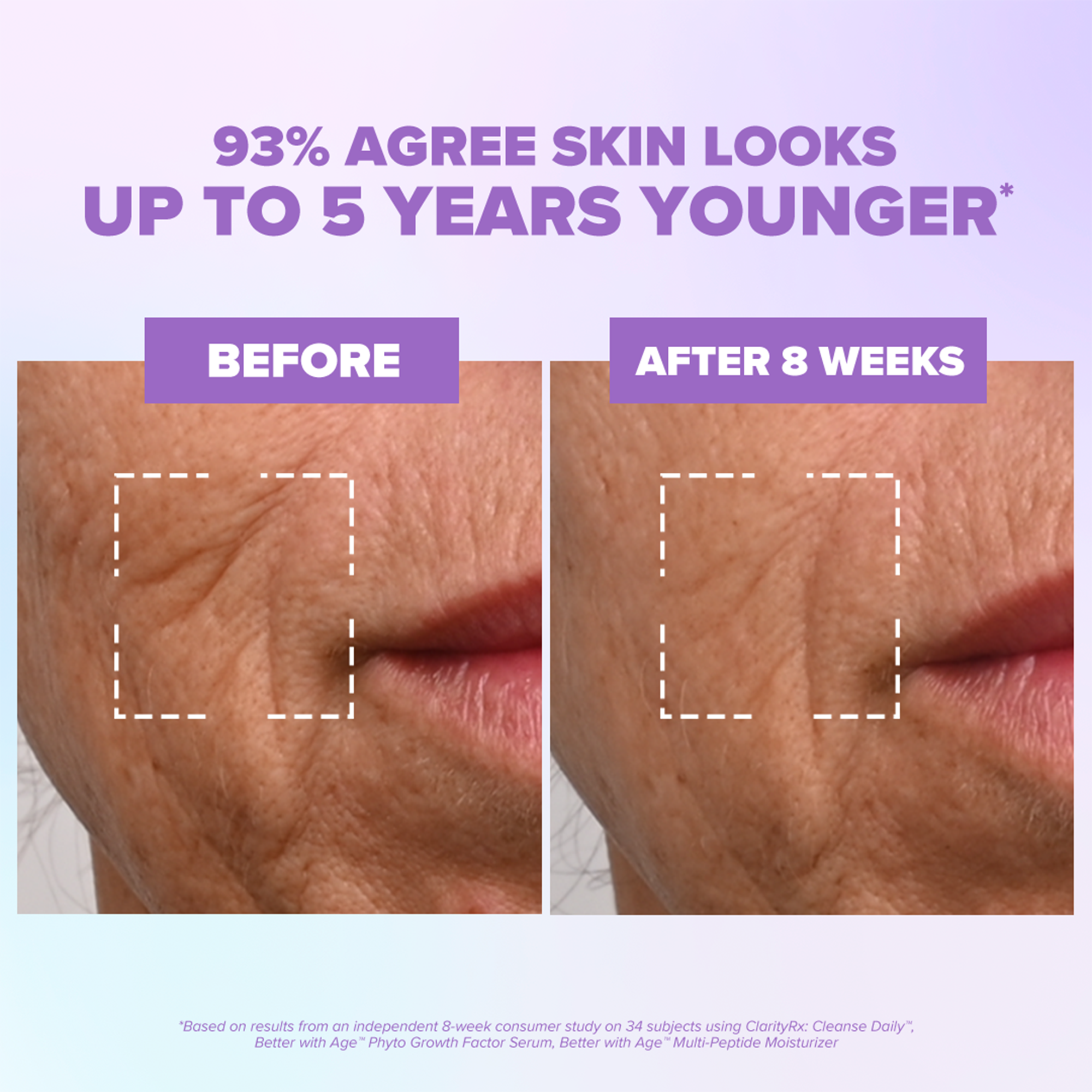 Better With Age™ Phyto Growth Factor Serum